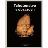 Kniha Fortuna Libri Tehotenstvo v obrazoch Michal Holáň a kolektív